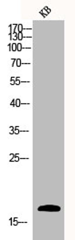 Western Blot analysis of KB cells using Caspase-3 Polyclonal Antibody