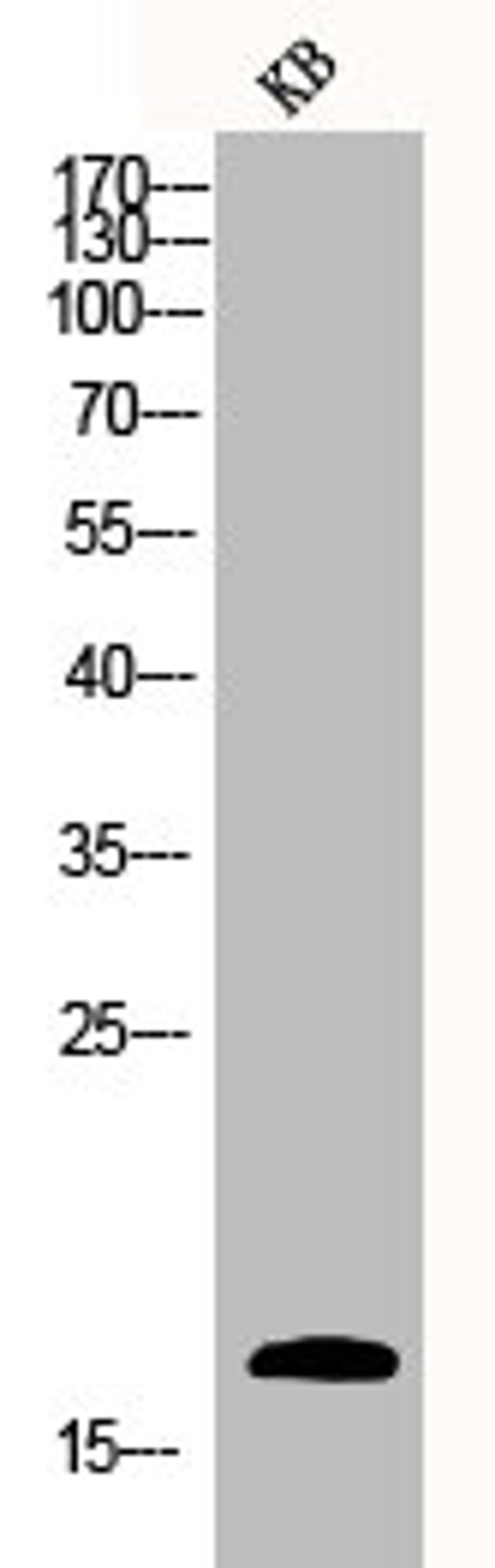 Western Blot analysis of KB cells using Caspase-3 Polyclonal Antibody
