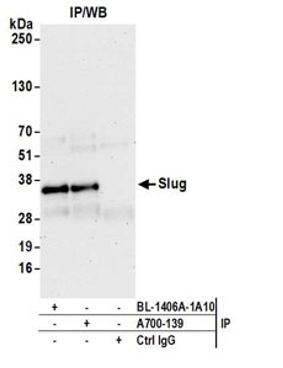 Detection of human Slug by western blot of immunoprecipitates.