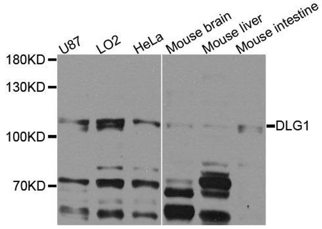 Western blot analysis of extracts of various cells using DLG1 antibody