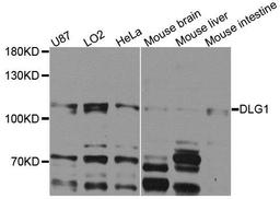 Western blot analysis of extracts of various cells using DLG1 antibody