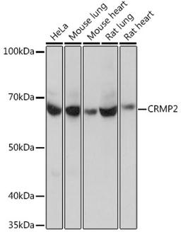 Western blot - CRMP2 Rabbit mAb (A4411)