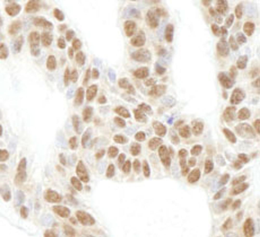 Detection of human expndtw-4 RPL26 by immunohistochemistry.