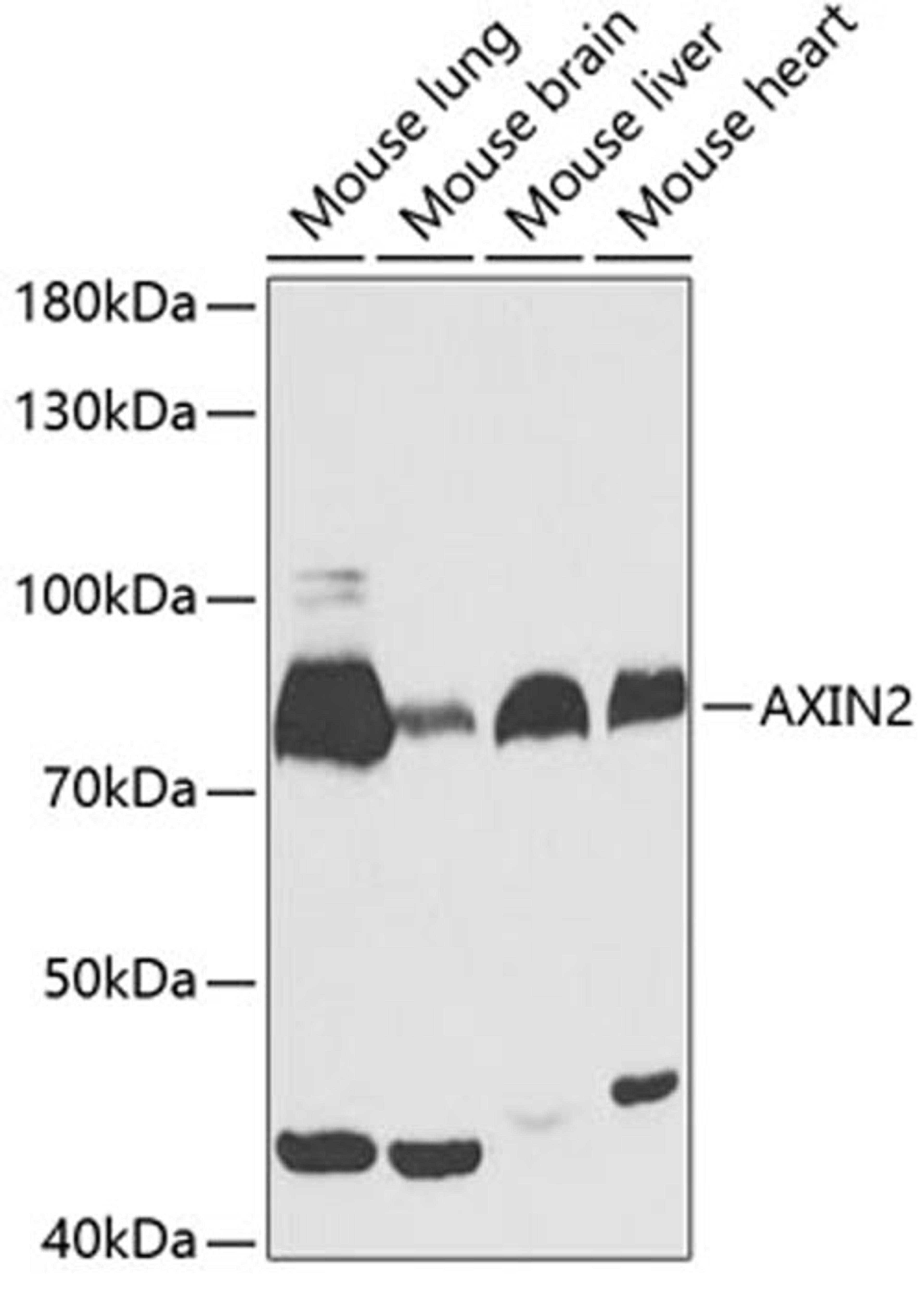 Western blot - AXIN2 antibody (A13373)