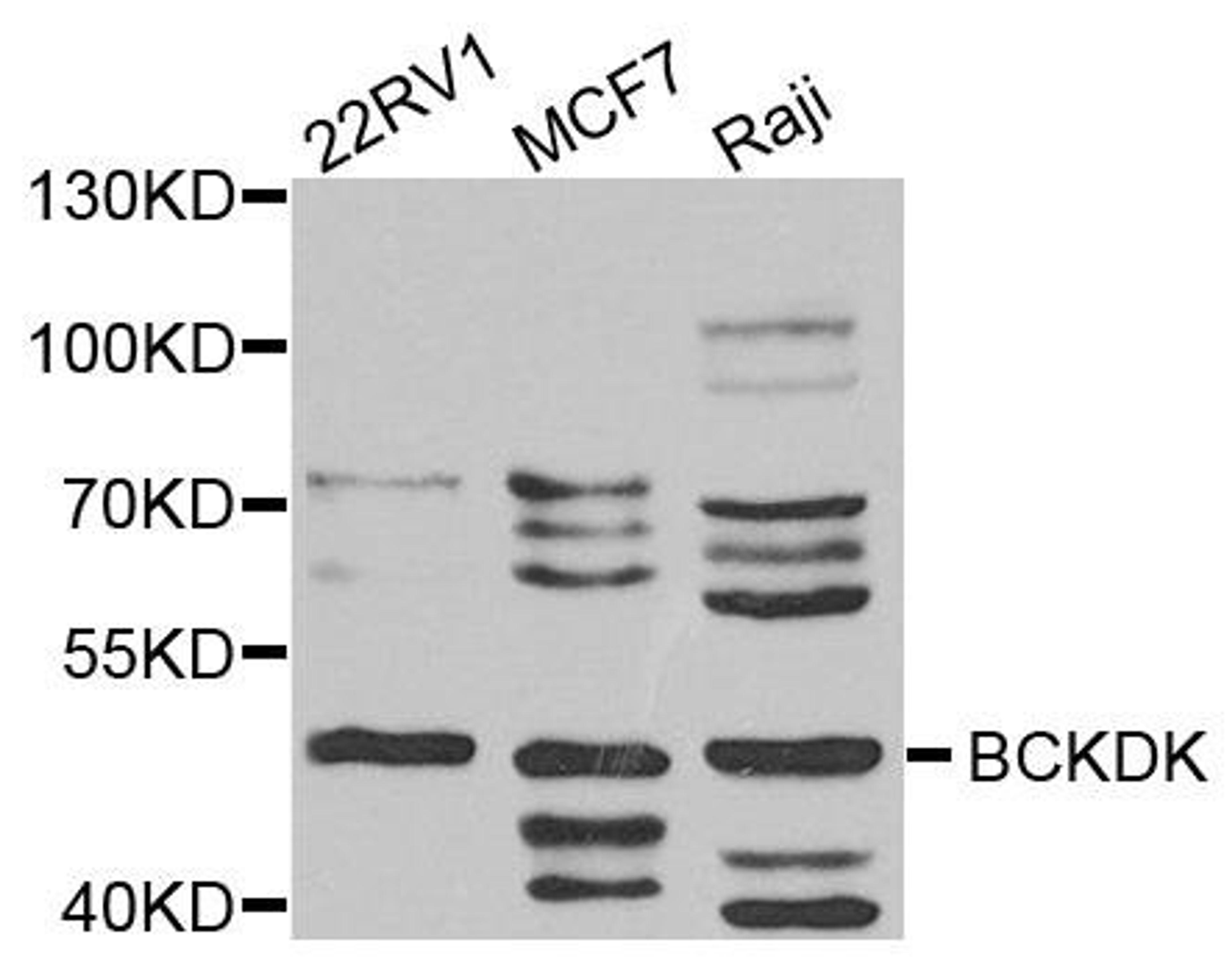 Western blot analysis of extract of various cells using BCKDK antibody