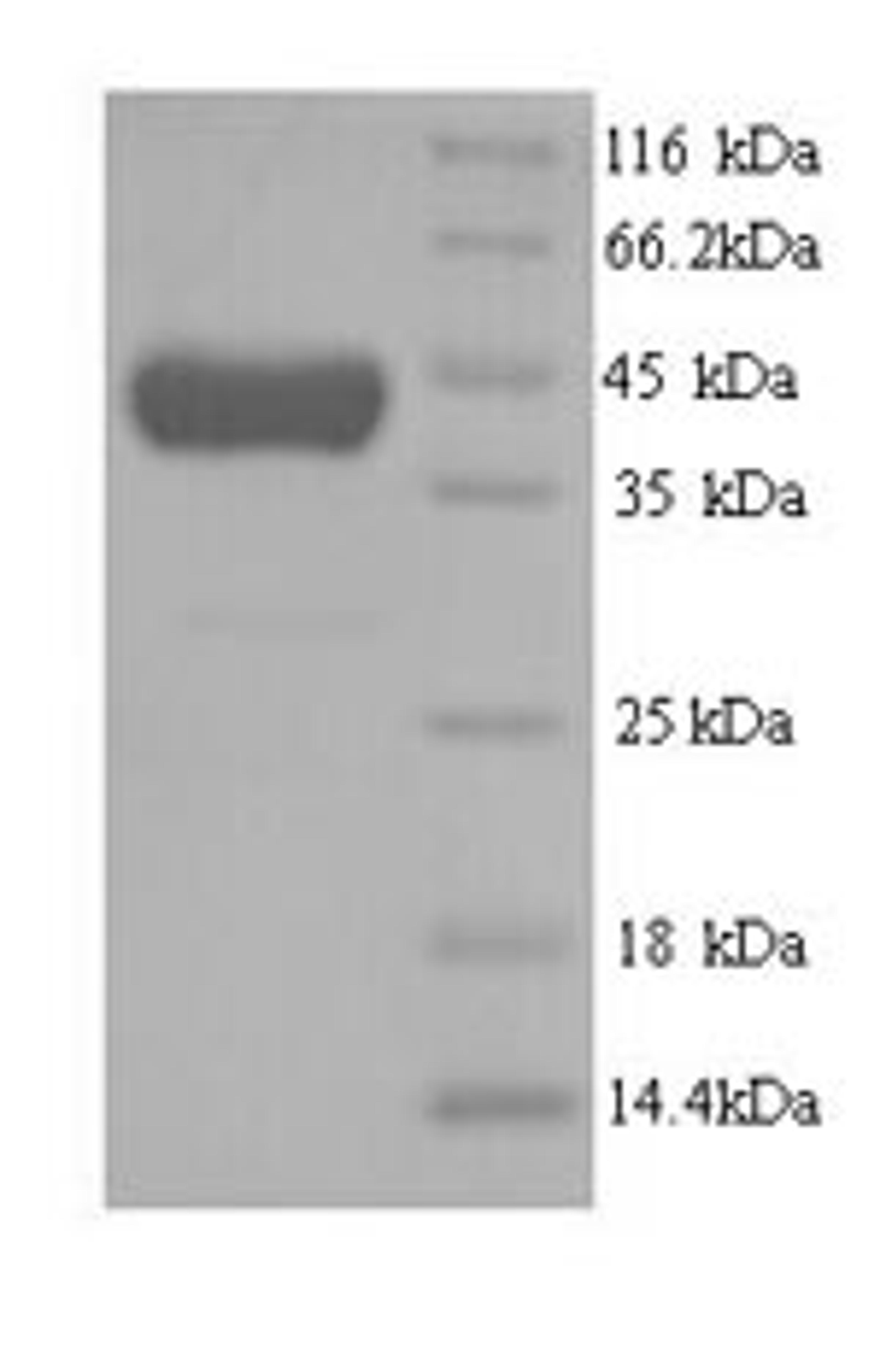 (Tris-Glycine gel) Discontinuous SDS-PAGE (reduced) with 5% enrichment gel and 15% separation gel.