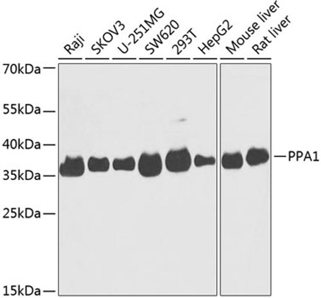 Western blot - PPA1 antibody (A14050)