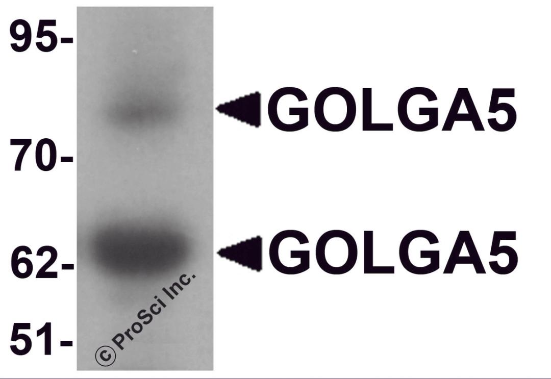 Western blot analysis of GOLGA5 in human testis tissue lysate with GOLGA5 antibody at 1 μg/mL.