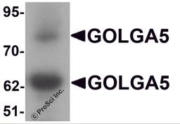 Western blot analysis of GOLGA5 in human testis tissue lysate with GOLGA5 antibody at 1 μg/mL.