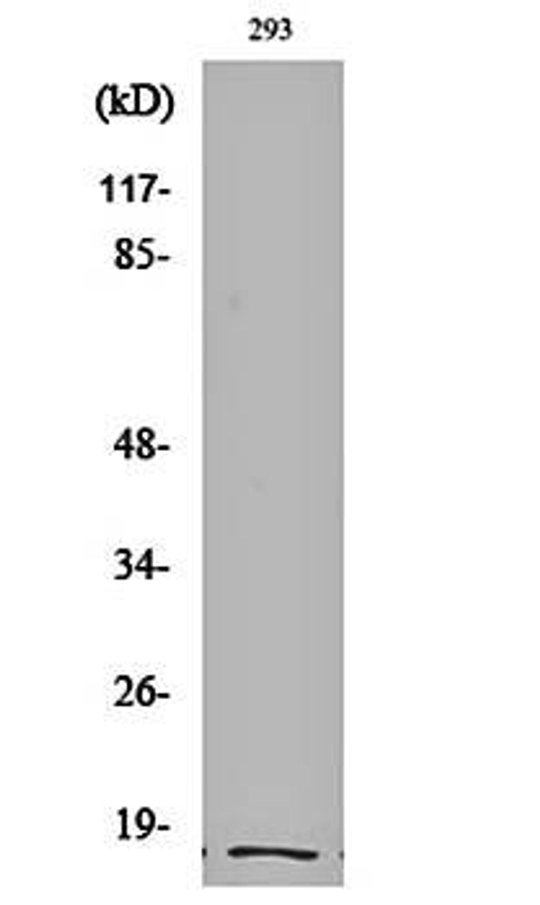 Western blot analysis of 293 cell lysates using Cleaved-Integrin alpha5 LC (E895) antibody