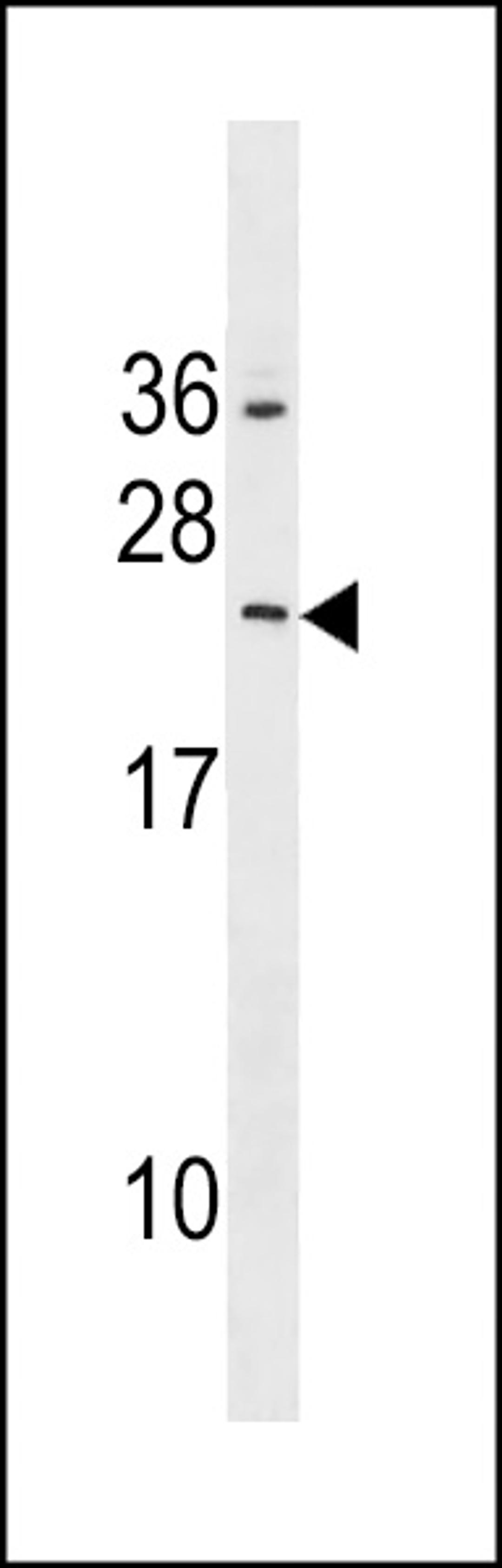 Western blot analysis in HepG2 cell line lysates (35ug/lane).