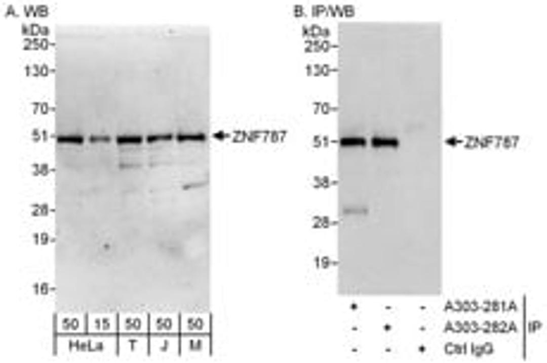 Detection of human and mouse ZNF787 by western blot (h and m) and immunoprecipitation (h).