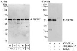 Detection of human and mouse ZNF787 by western blot (h and m) and immunoprecipitation (h).