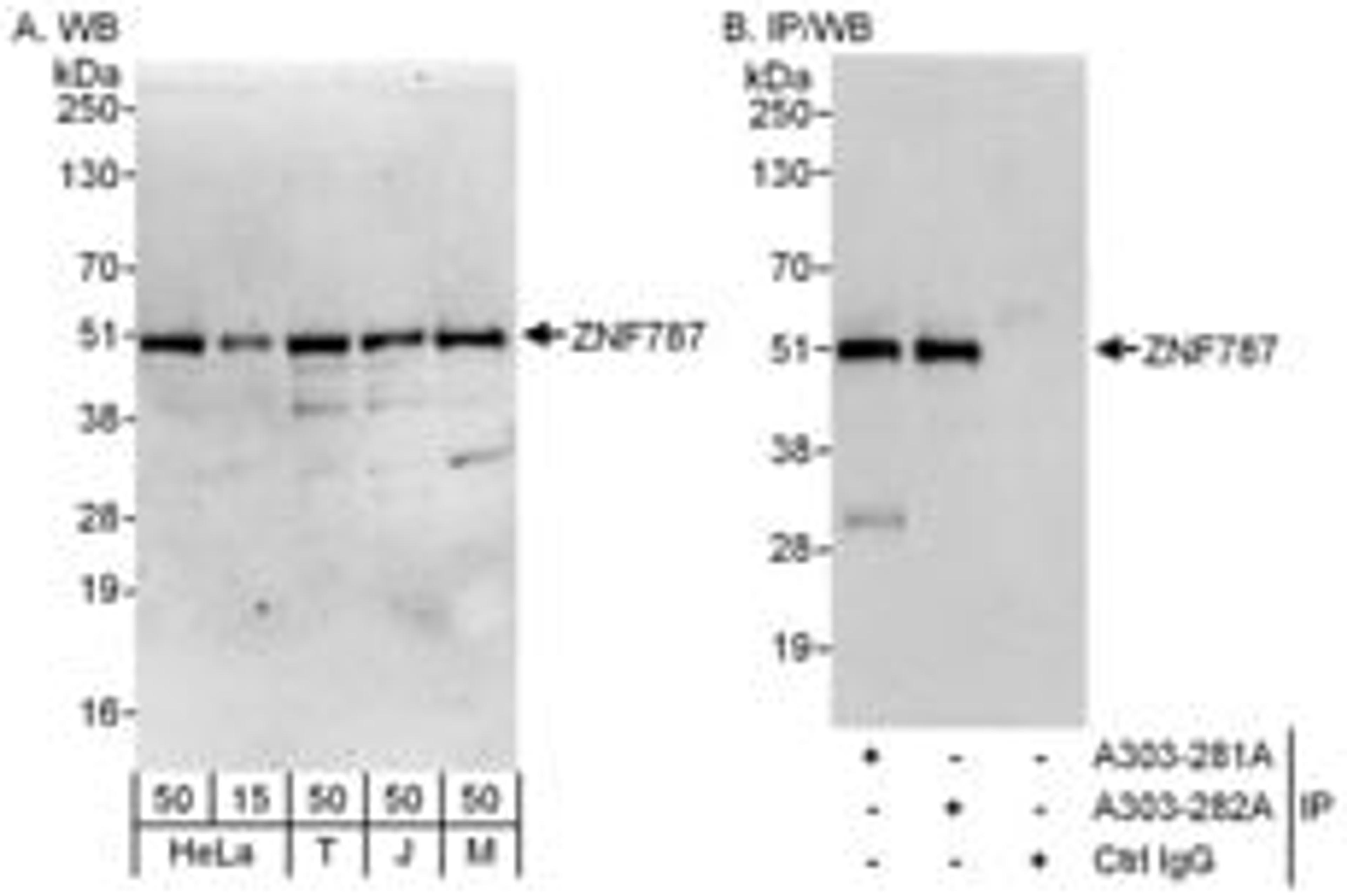 Detection of human and mouse ZNF787 by western blot (h and m) and immunoprecipitation (h).