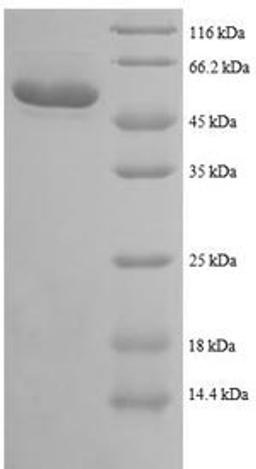 (Tris-Glycine gel) Discontinuous SDS-PAGE (reduced) with 5% enrichment gel and 15% separation gel.