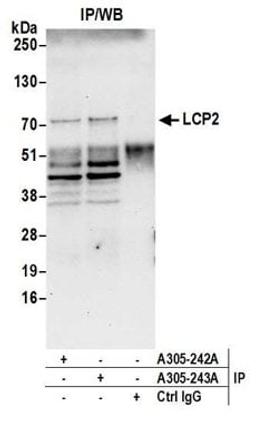 Detection of human LCP2 by western blot of immunoprecipitates.