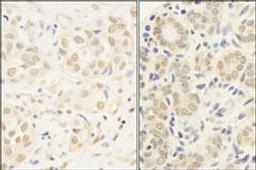 Detection of human c-Myb by immunohistochemistry.