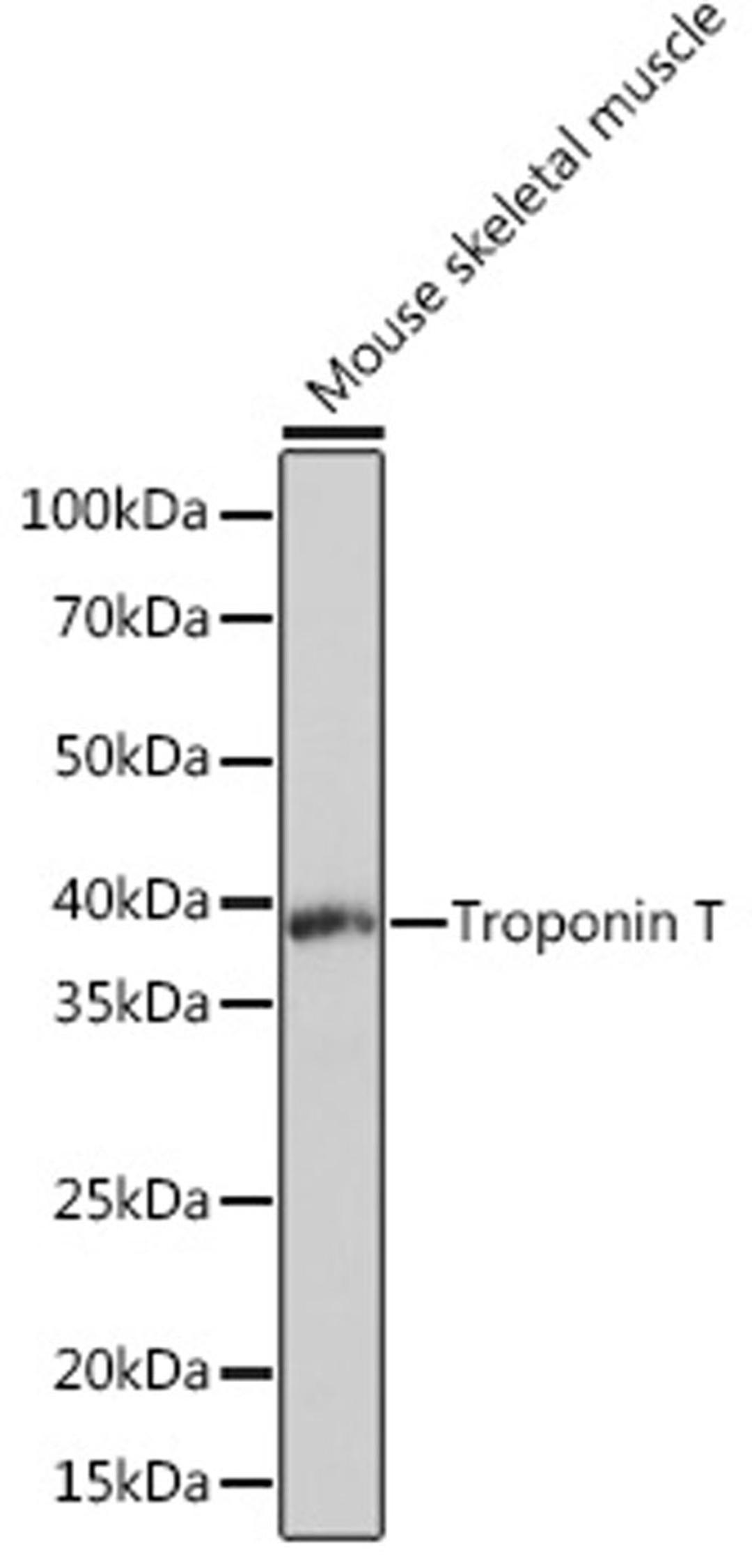 Western blot - Troponin T Rabbit mAb (A4914)