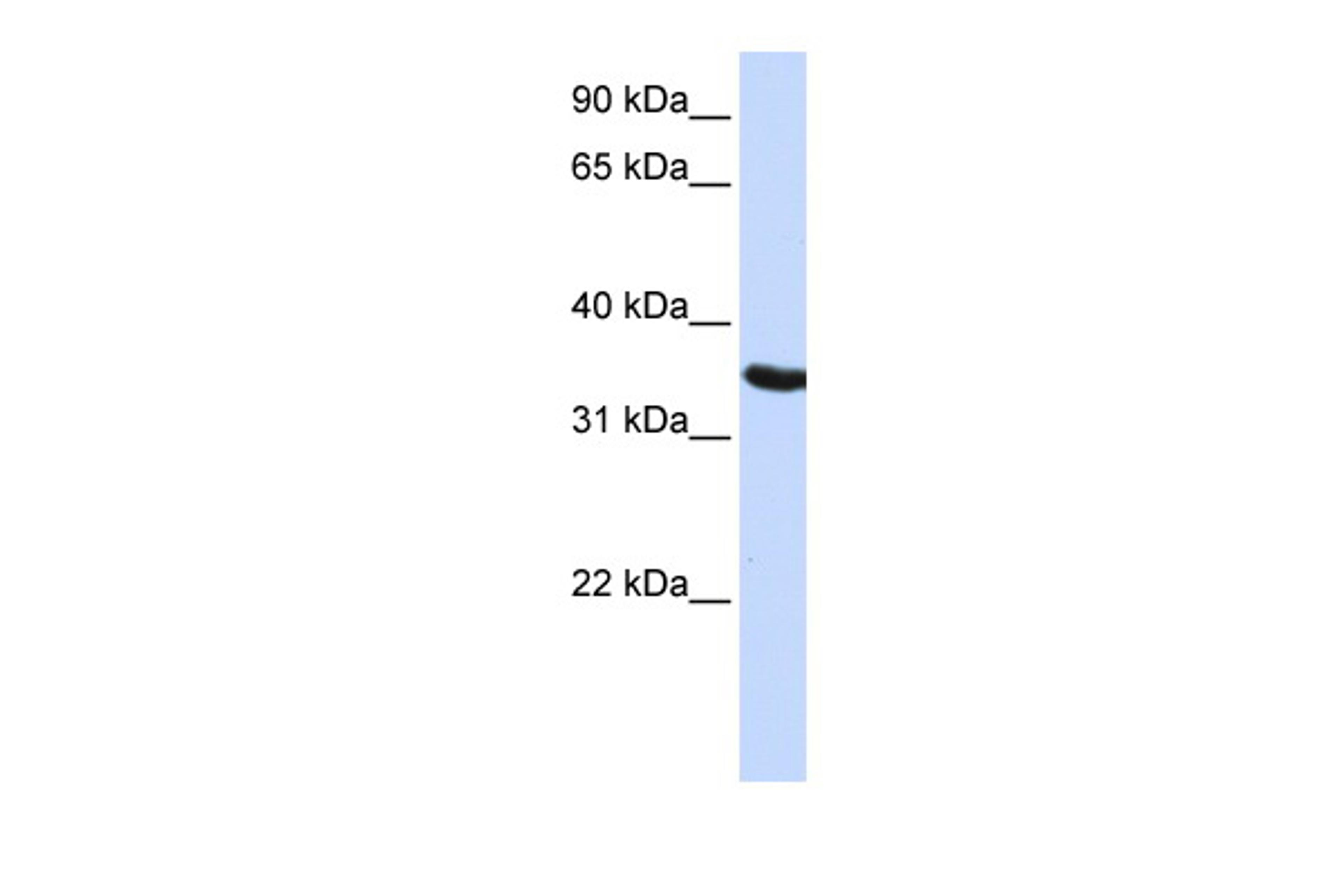 Antibody used in WB on Human HepG2 at 0.2-1 ug/ml.