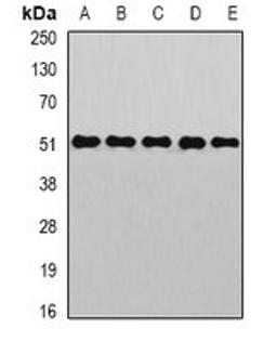 Western blot analysis of HepG2 (Lane1), Hela (Lane2), mouse kidney (Lane3), mouse liver (Lane4), rat brain (Lane5) whole cell lysates using GOPC antibody