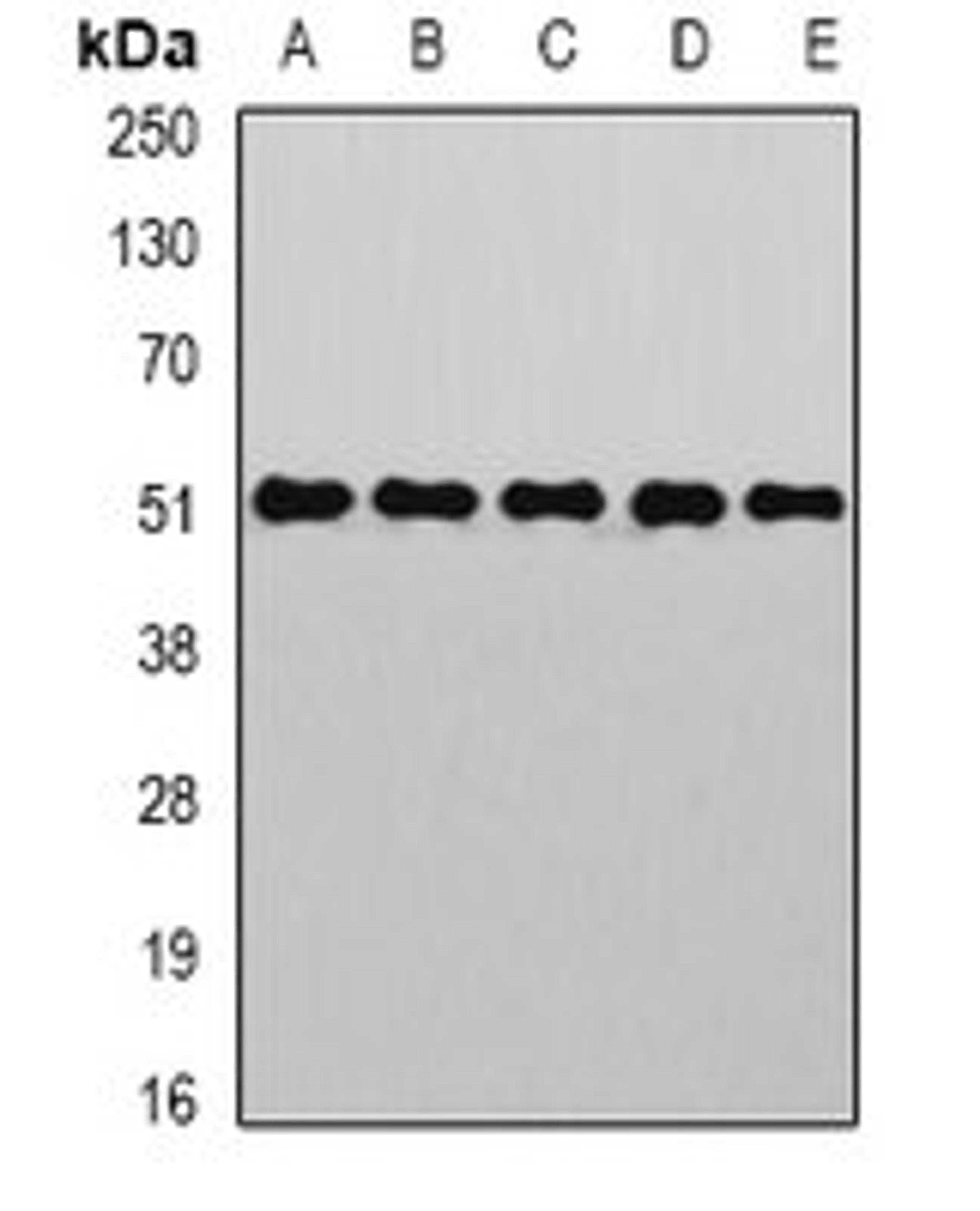 Western blot analysis of HepG2 (Lane1), Hela (Lane2), mouse kidney (Lane3), mouse liver (Lane4), rat brain (Lane5) whole cell lysates using GOPC antibody