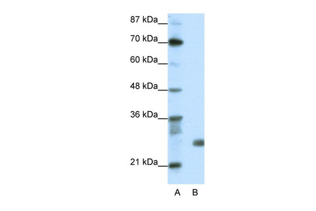 Antibody used in WB on Transfected 293T at 1.25 ug/ml.