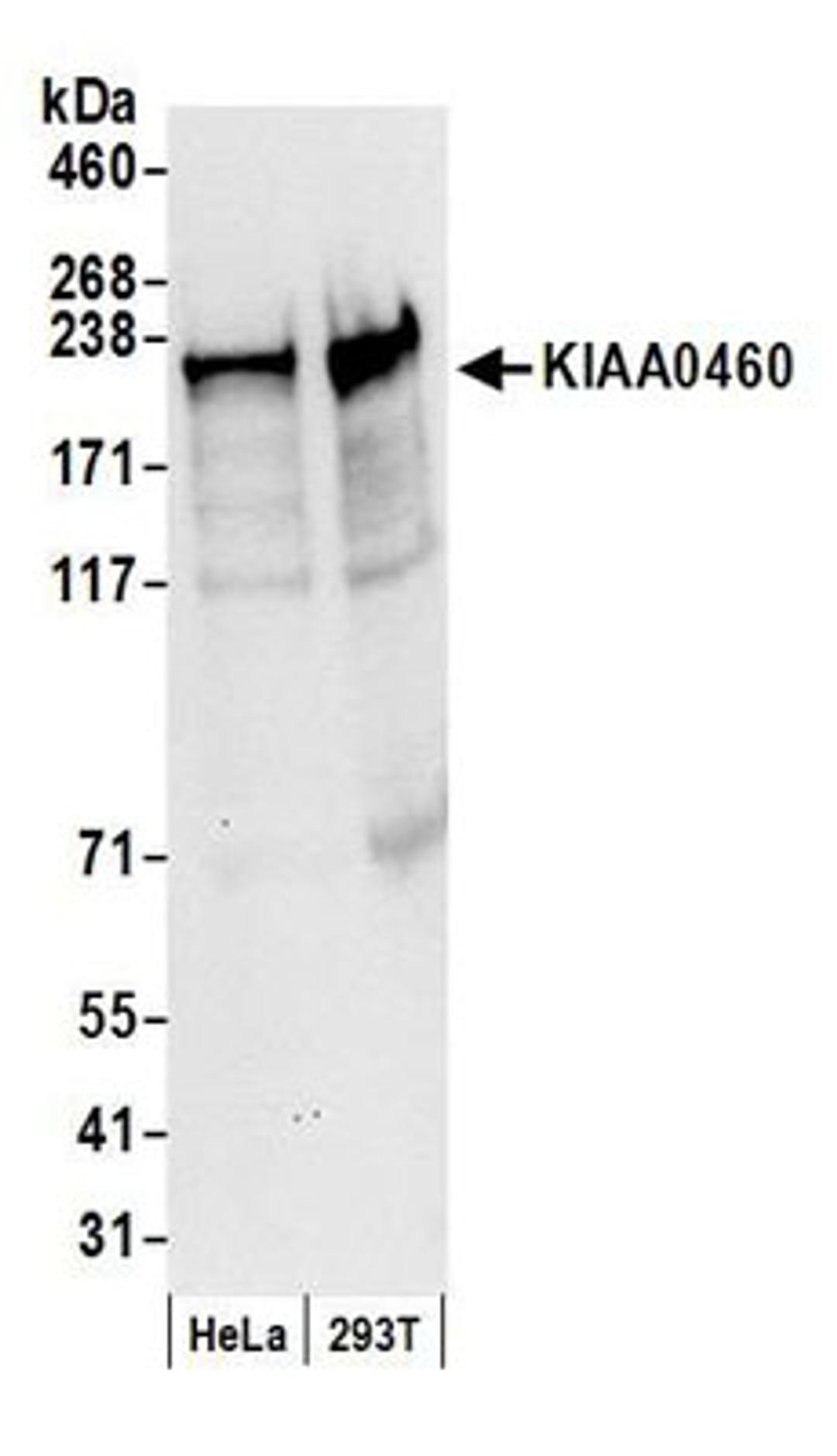 Detection of human KIAA0460 by western blot.