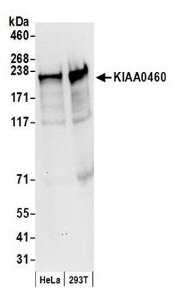 Detection of human KIAA0460 by western blot.