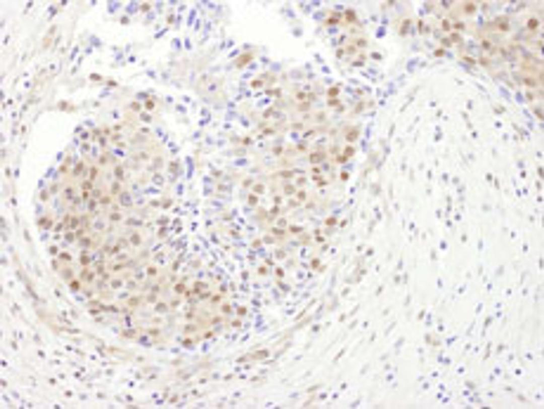 Detection of human PSMD1 by immunohistochemistry.