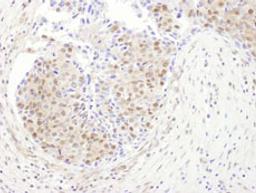 Detection of human PSMD1 by immunohistochemistry.