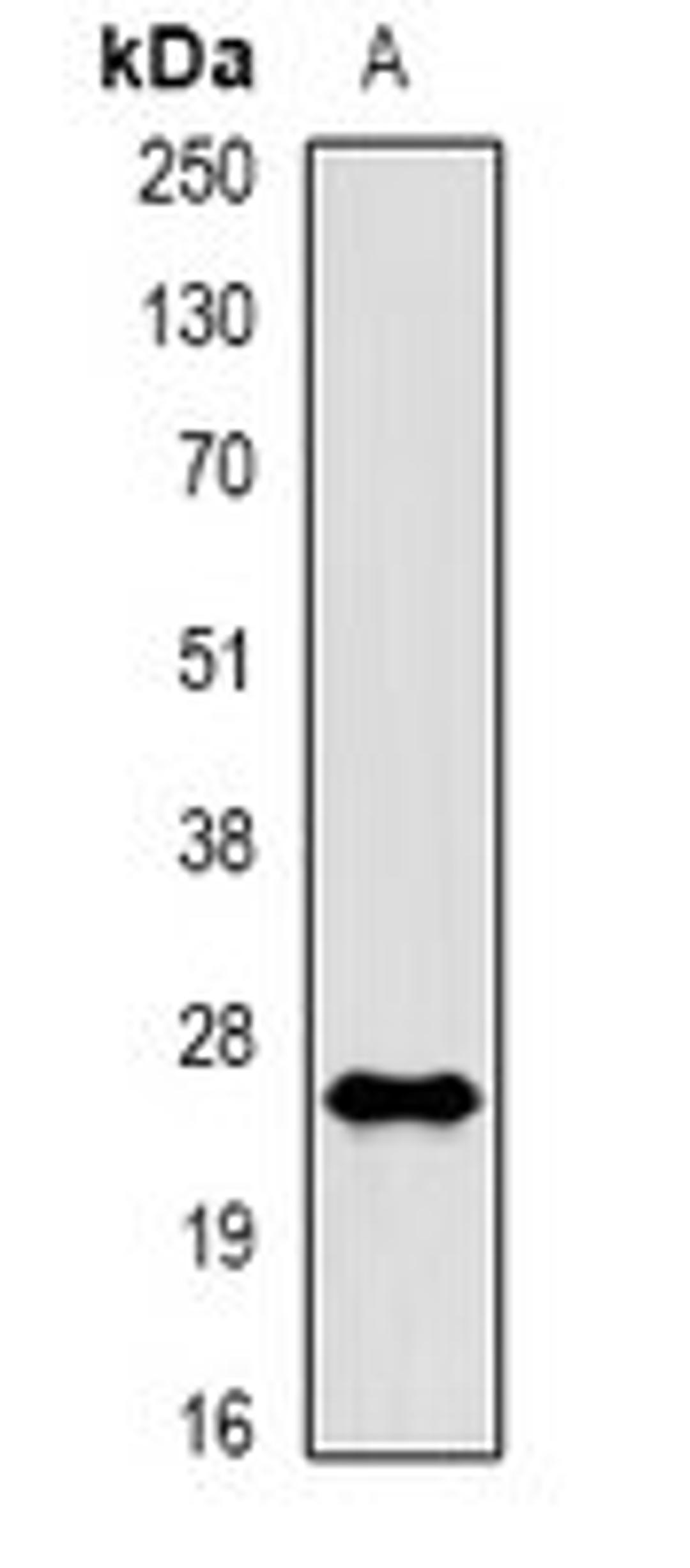 Western blot analysis of A431 EGF-treated (Lane1) whole cell lysates using RAC 1 (phospho-S71) antibody