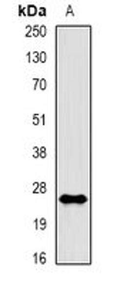 Western blot analysis of A431 EGF-treated (Lane1) whole cell lysates using RAC 1 (phospho-S71) antibody