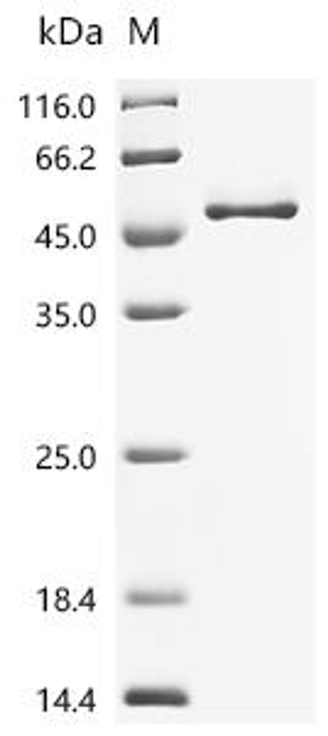 (Tris-Glycine gel) Discontinuous SDS-PAGE (reduced) with 5% enrichment gel and 15% separation gel.