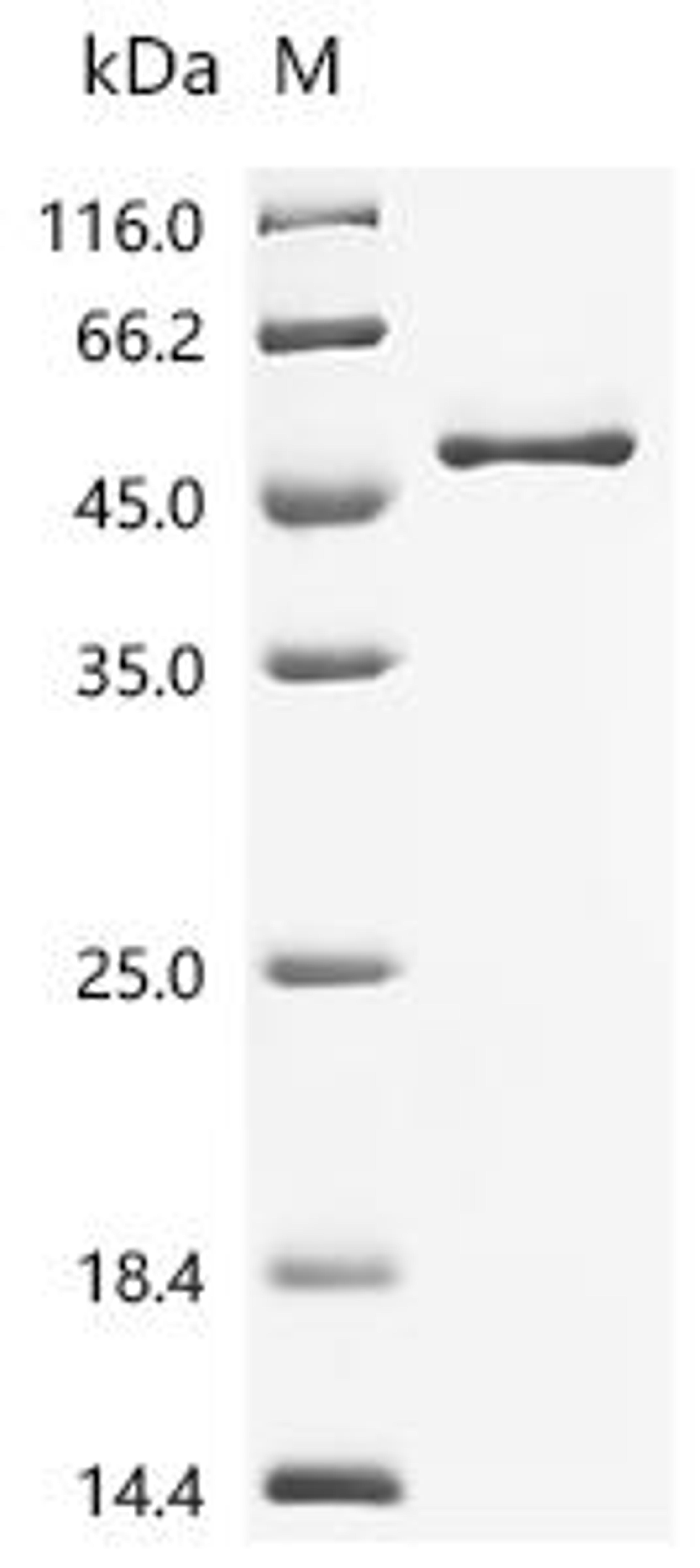 (Tris-Glycine gel) Discontinuous SDS-PAGE (reduced) with 5% enrichment gel and 15% separation gel.