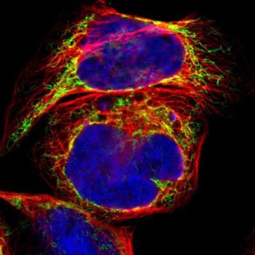 Immunocytochemistry/Immunofluorescence: ACAT1 Antibody [NBP1-89285] - Staining of human cell line A-431 shows positivity in mitochondria.