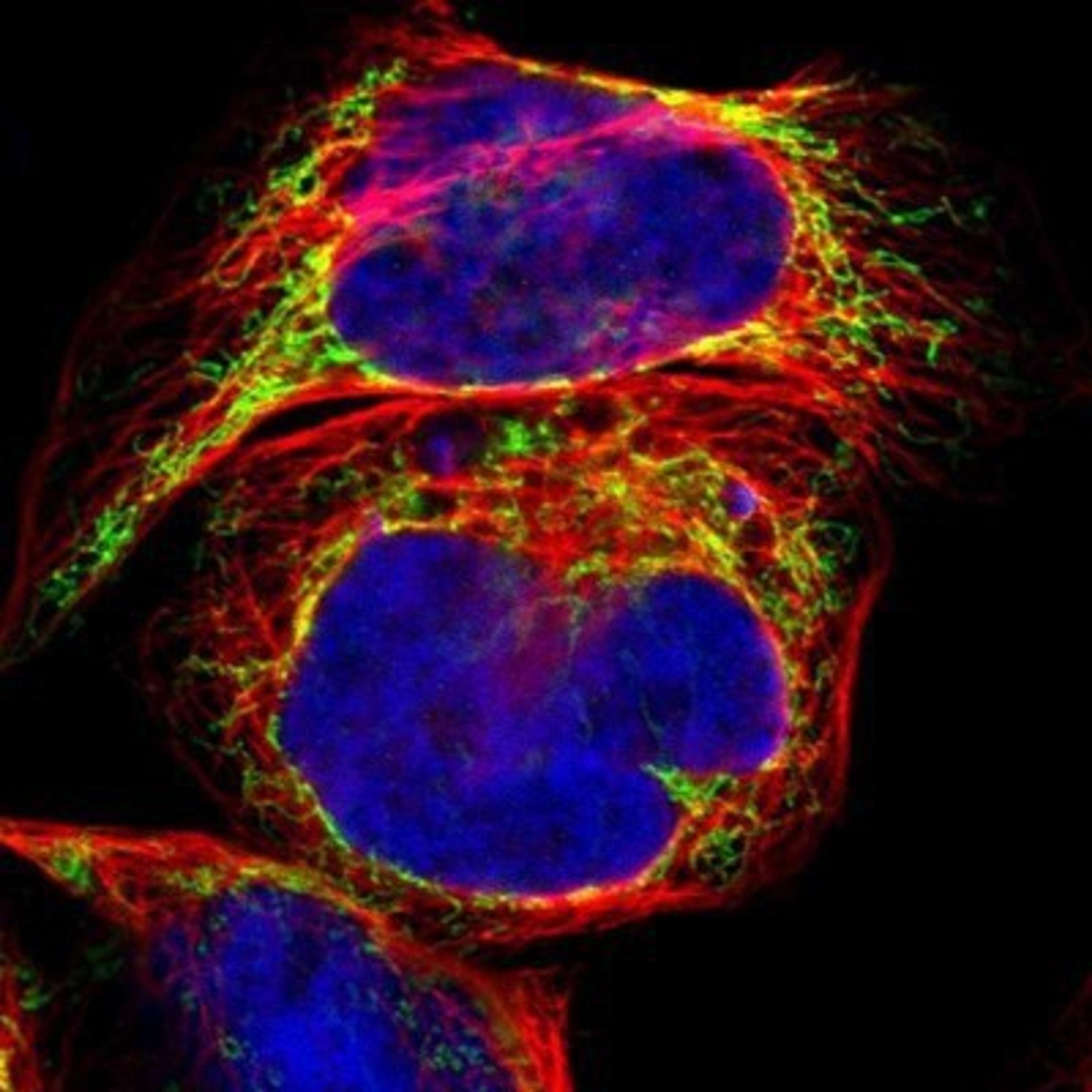 Immunocytochemistry/Immunofluorescence: ACAT1 Antibody [NBP1-89285] - Staining of human cell line A-431 shows positivity in mitochondria.