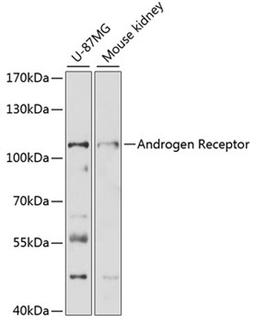 Western blot - Androgen Receptor antibody (A16200)