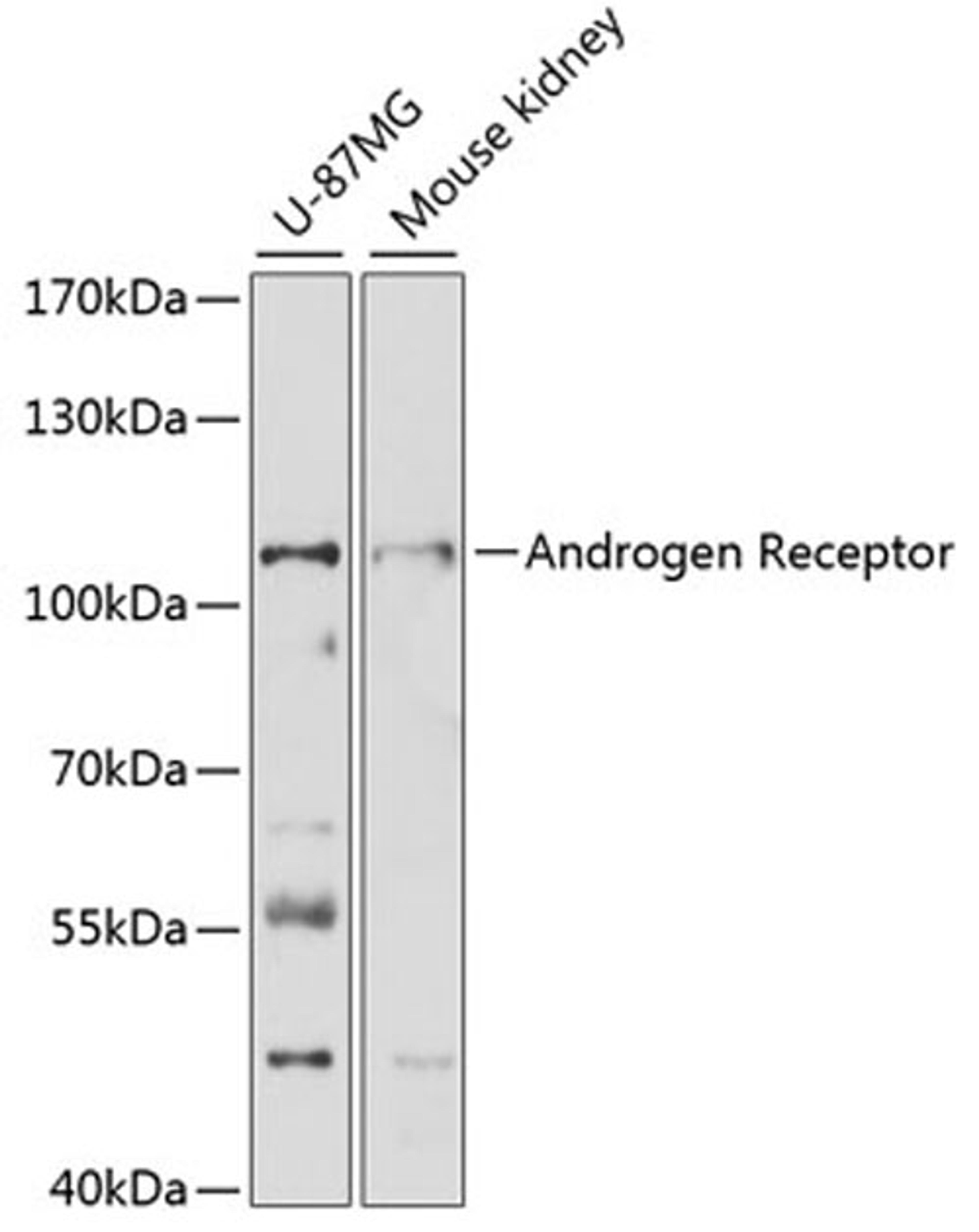 Western blot - Androgen Receptor antibody (A16200)