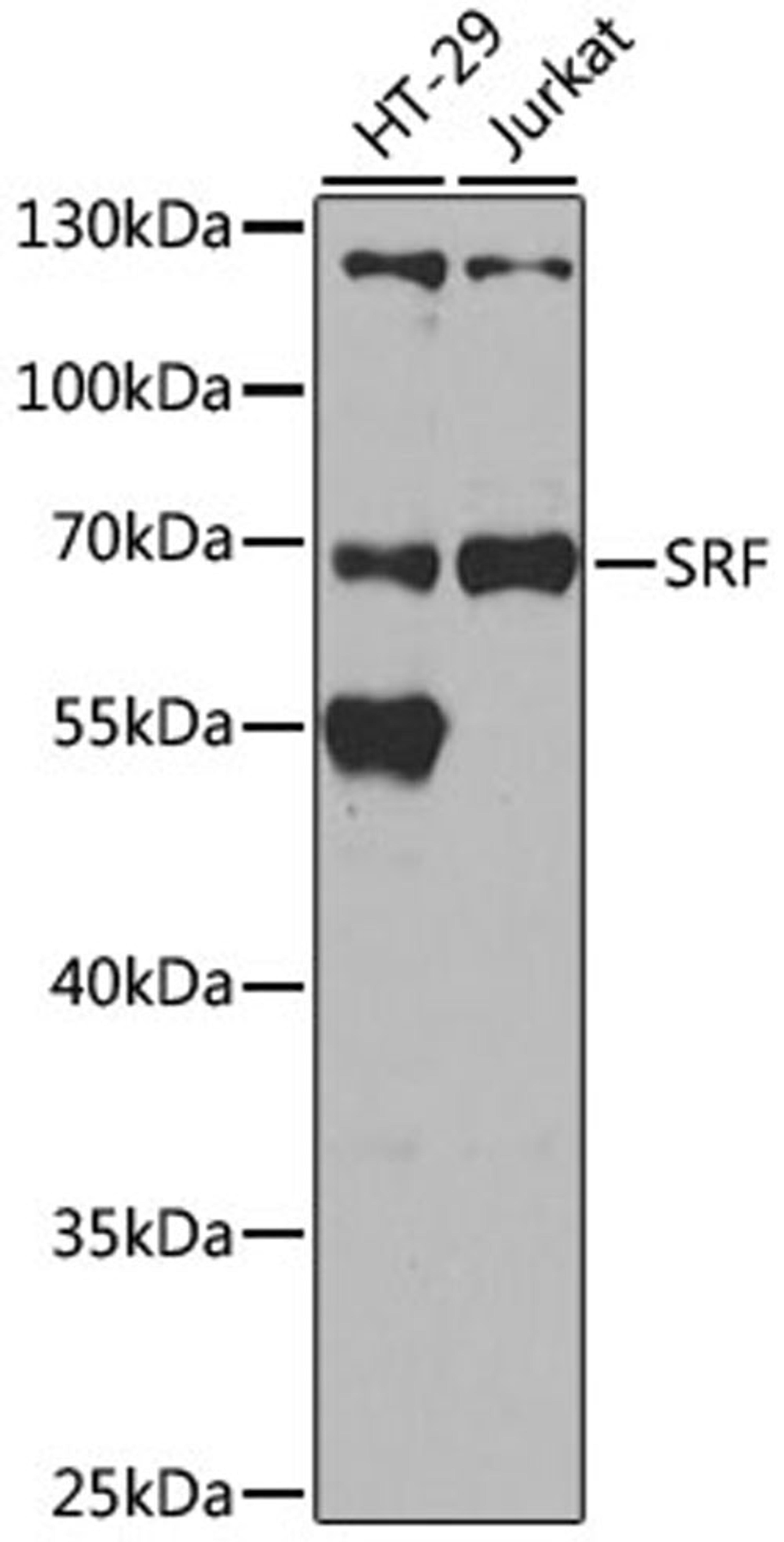 Western blot - SRF antibody (A7731)