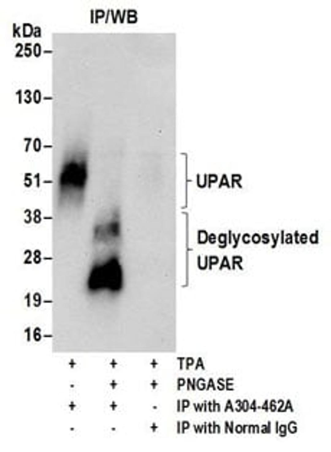 Detection of human glycosylated and deglycosylated UPAR by western blot of immunoprecipitates.