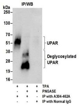 Detection of human glycosylated and deglycosylated UPAR by western blot of immunoprecipitates.