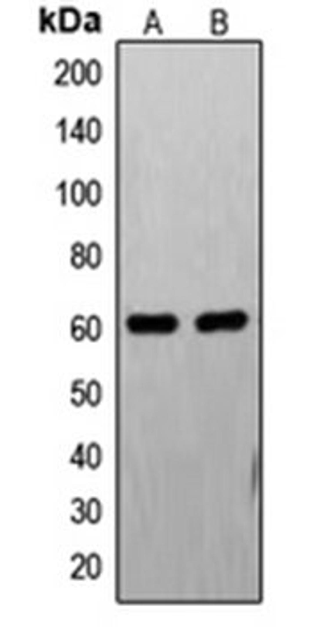 Western blot analysis of PC12 (Lane 1), HL60 (Lane 2) whole cell lysates using FASTK antibody