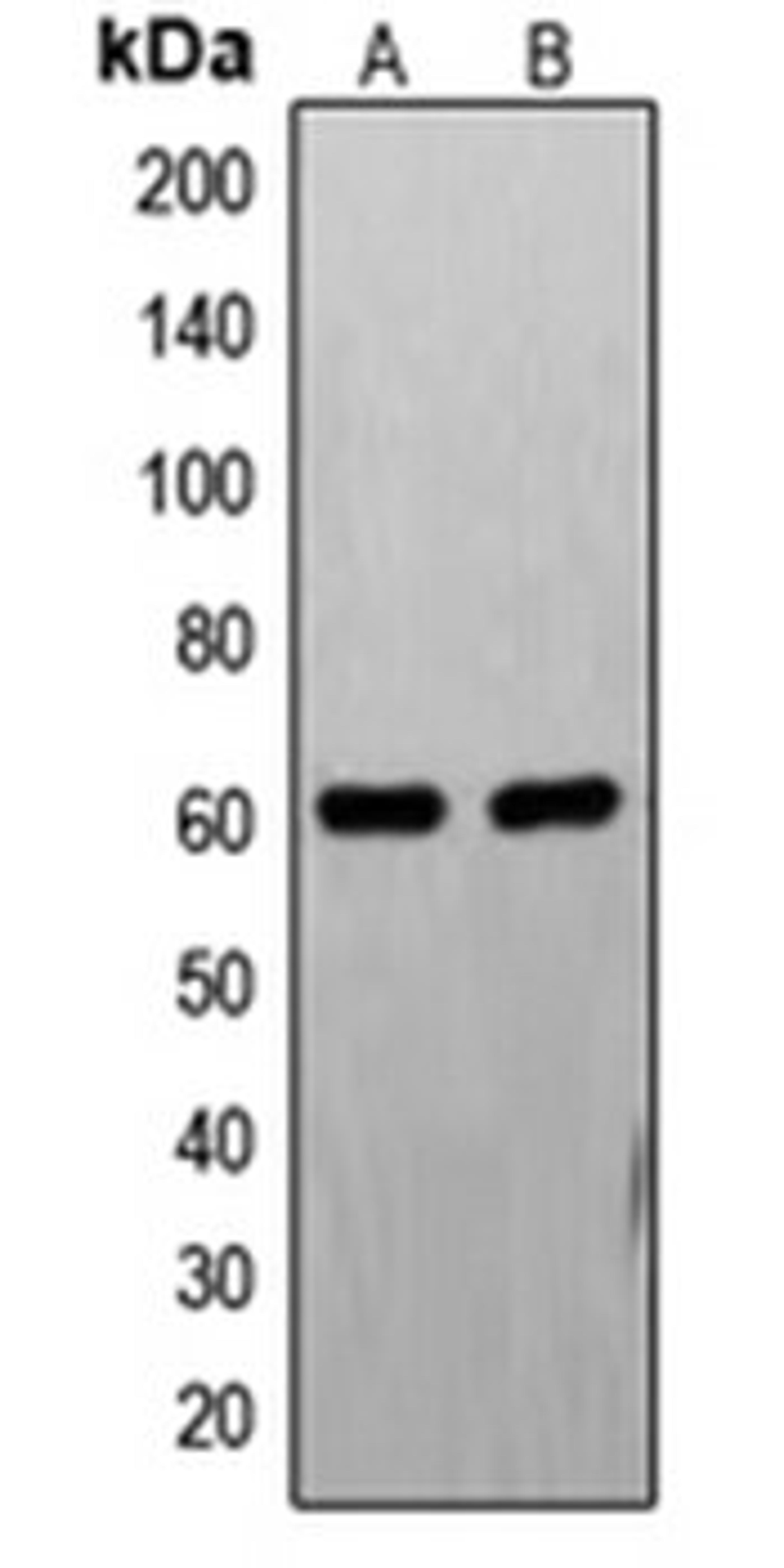 Western blot analysis of PC12 (Lane 1), HL60 (Lane 2) whole cell lysates using FASTK antibody