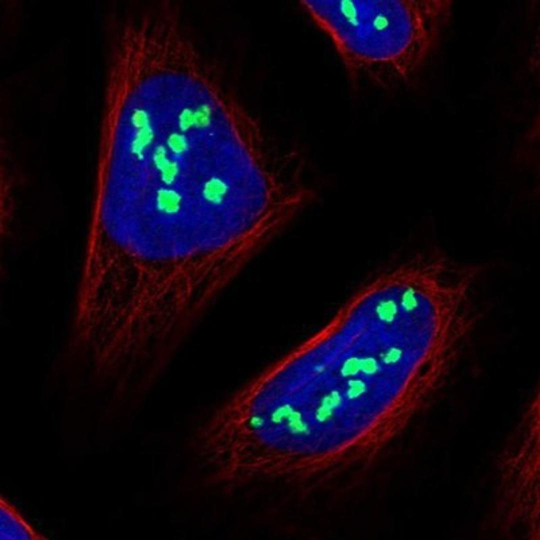 Immunocytochemistry/Immunofluorescence: NOC2L Antibody [NBP1-92190] - Staining of human cell line U-2 OS shows positivity in nucleoli.