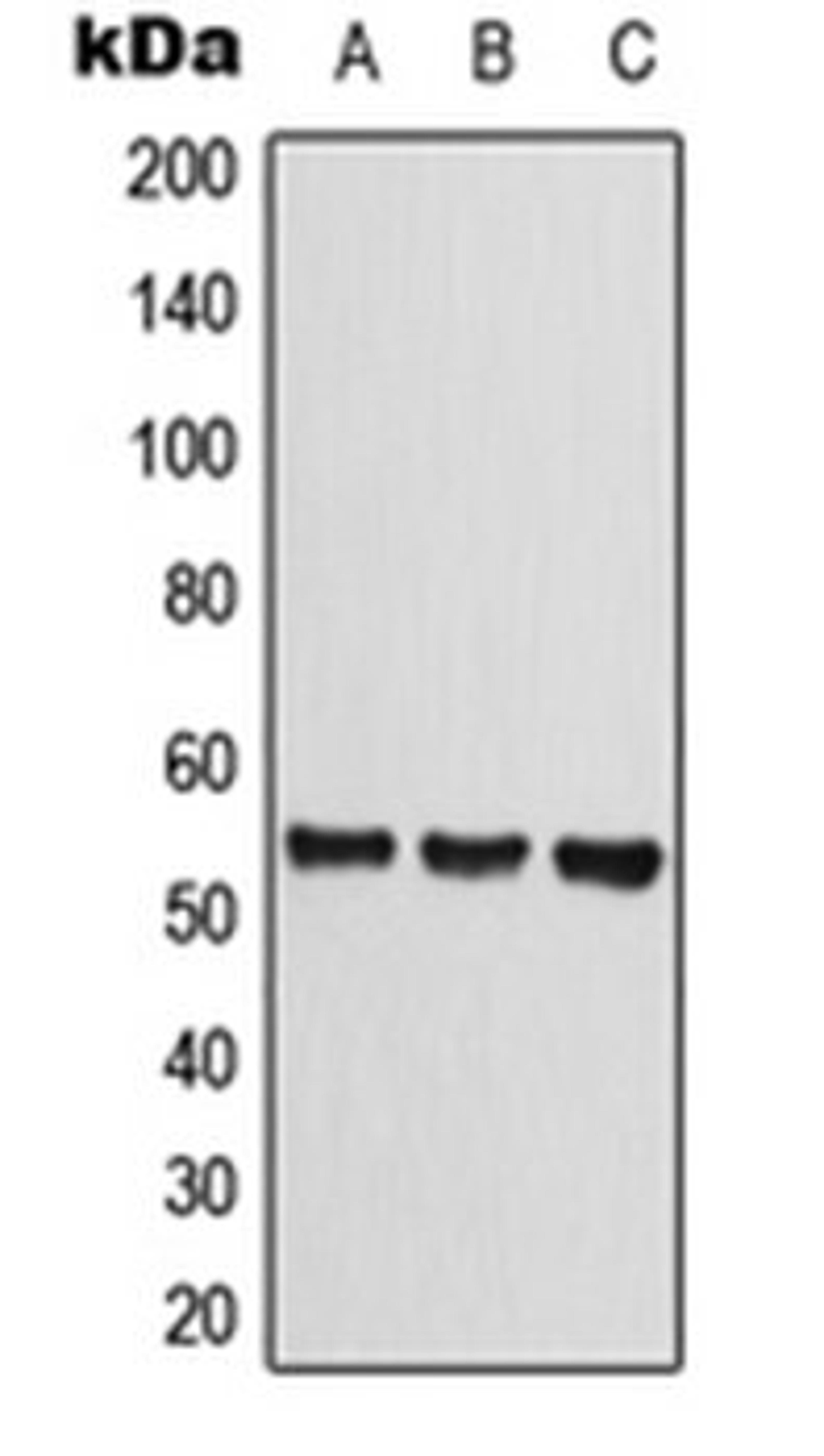 Western blot analysis of HEK293T (Lane 1), Raw264.7 (Lane 2), rat liver (Lane 3) whole cell lysates using CLEC14A antibody