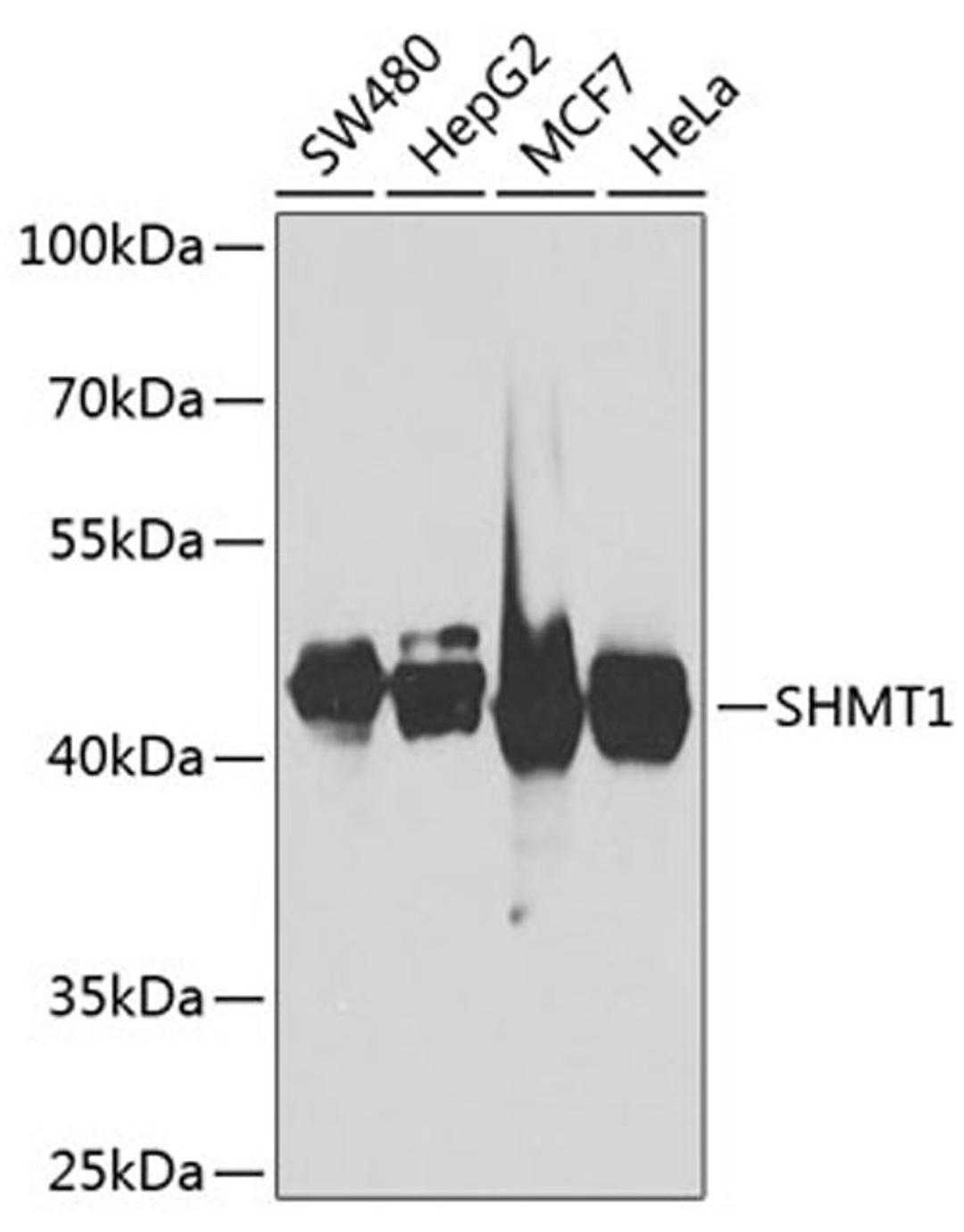 Western blot - SHMT1 antibody (A7727)