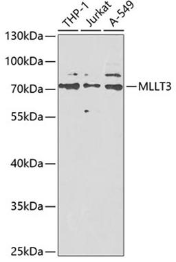 Western blot - MLLT3 antibody (A6798)