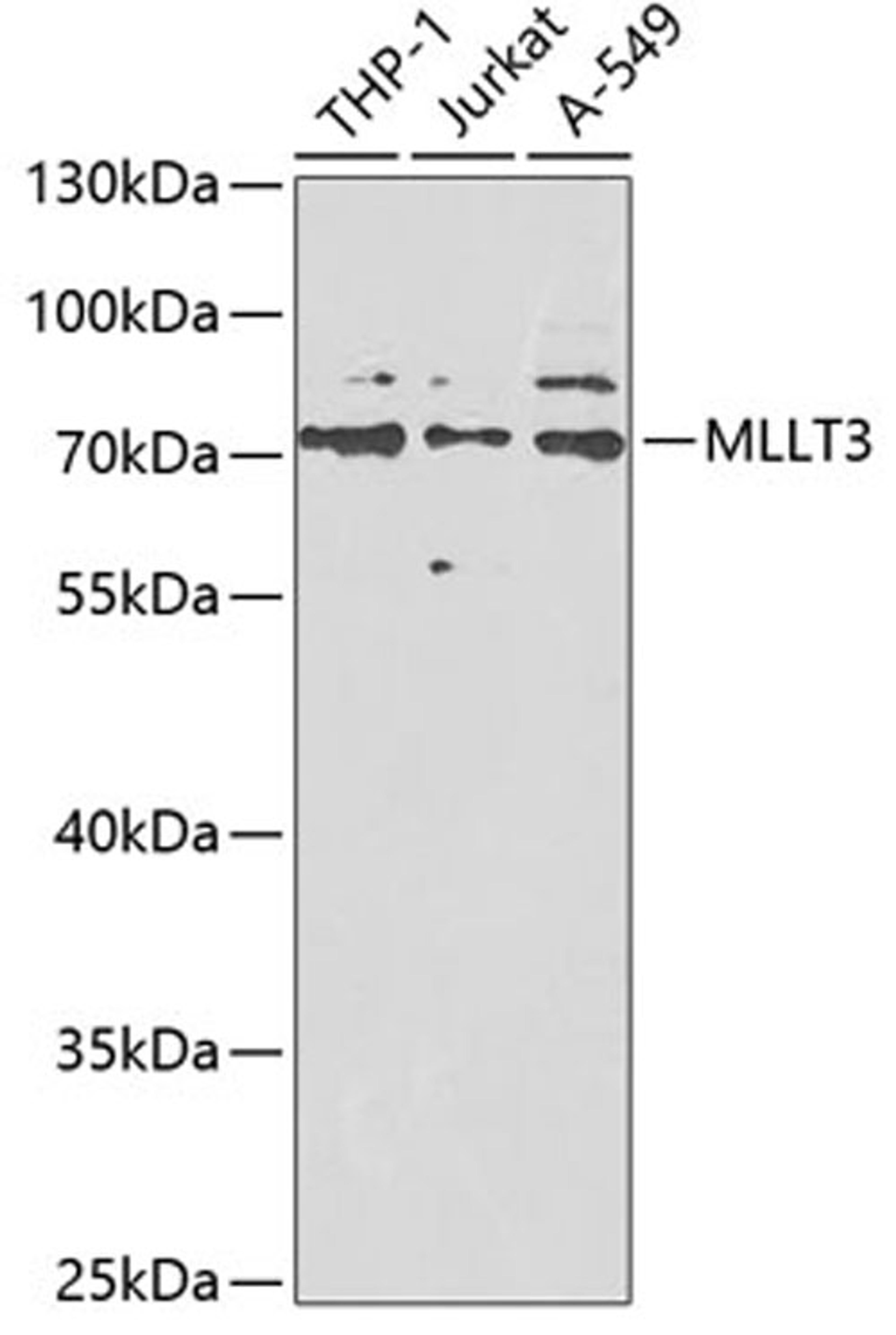 Western blot - MLLT3 antibody (A6798)