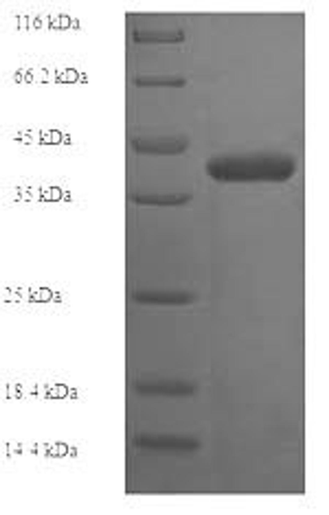 (Tris-Glycine gel) Discontinuous SDS-PAGE (reduced) with 5% enrichment gel and 15% separation gel.