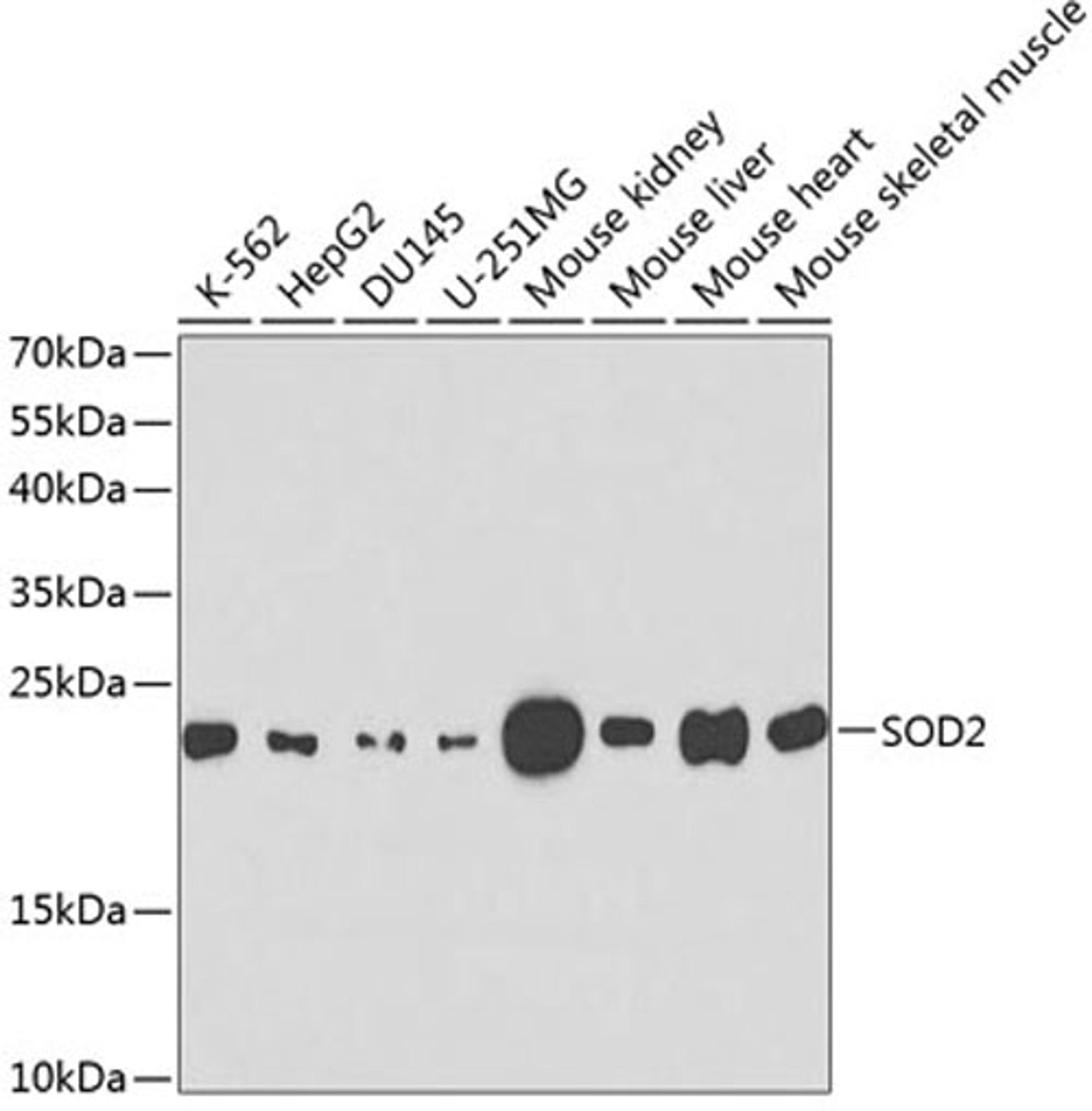 Western blot - SOD2 antibody (A1340)